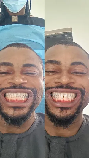 Teeth Whitening Services