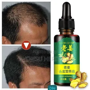 Hair Growth Oil