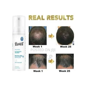 Bunee Signature 5% Minoxidil Hair Growth Treatment, Aerosol 3 in 1