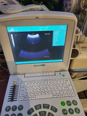 Edan Dus 60 Portable Ultrasound Machine – Fully Functional Clean