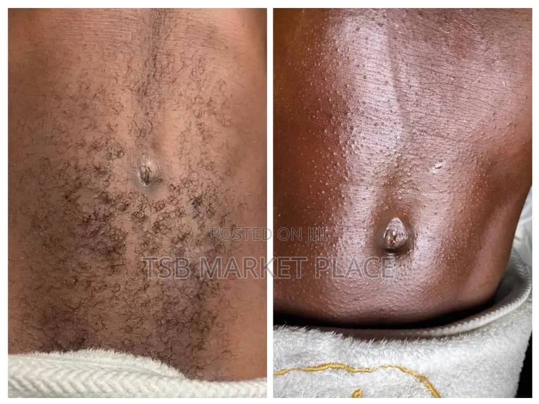 Sugar Waxing