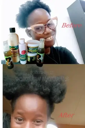 Grow Your Hair Back Like a Pro