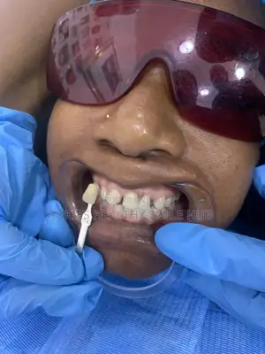 Premium Teeth Whitening