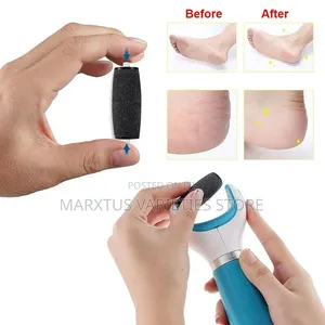 Cordless Electric Callus Remover
