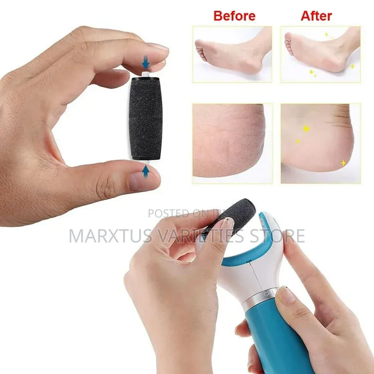 Cordless Electric Callus Remover
