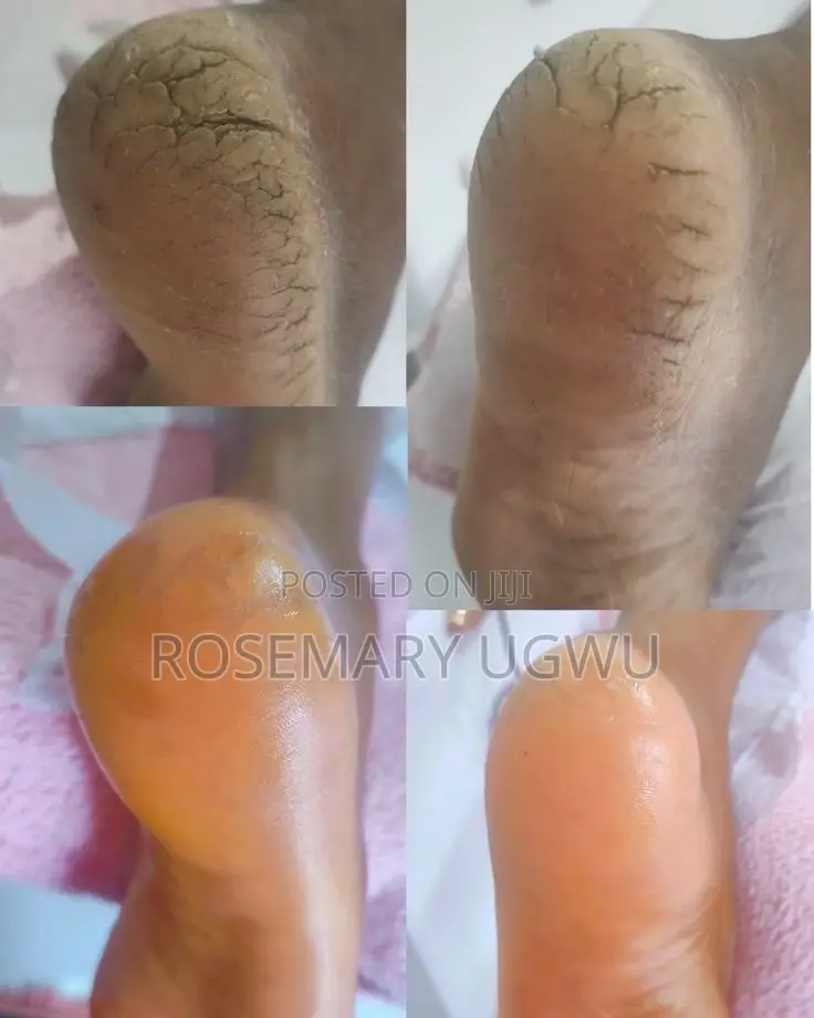 Pedicure and Manicure