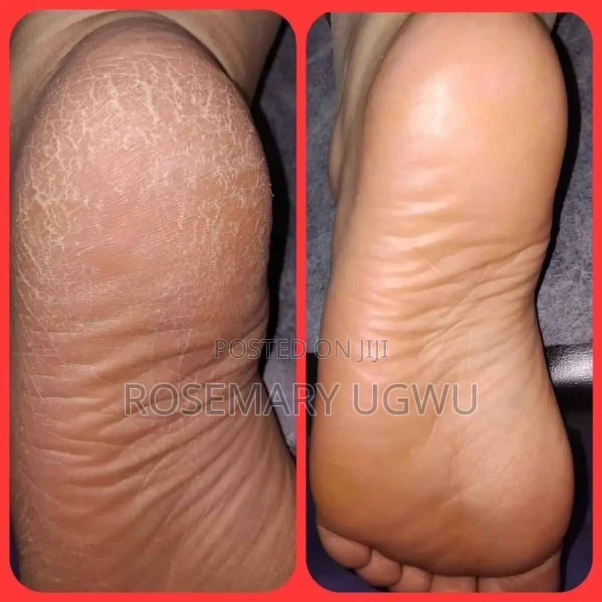 Pedicure and Manicure