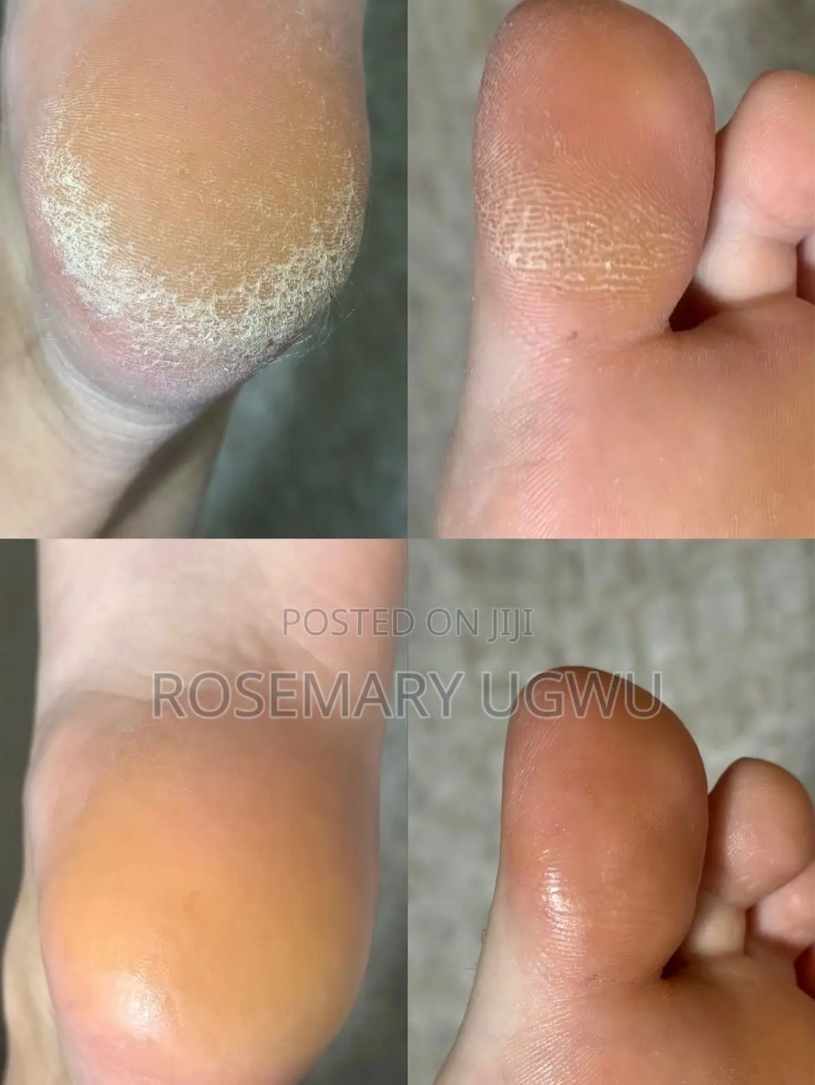 Pedicure and Manicure