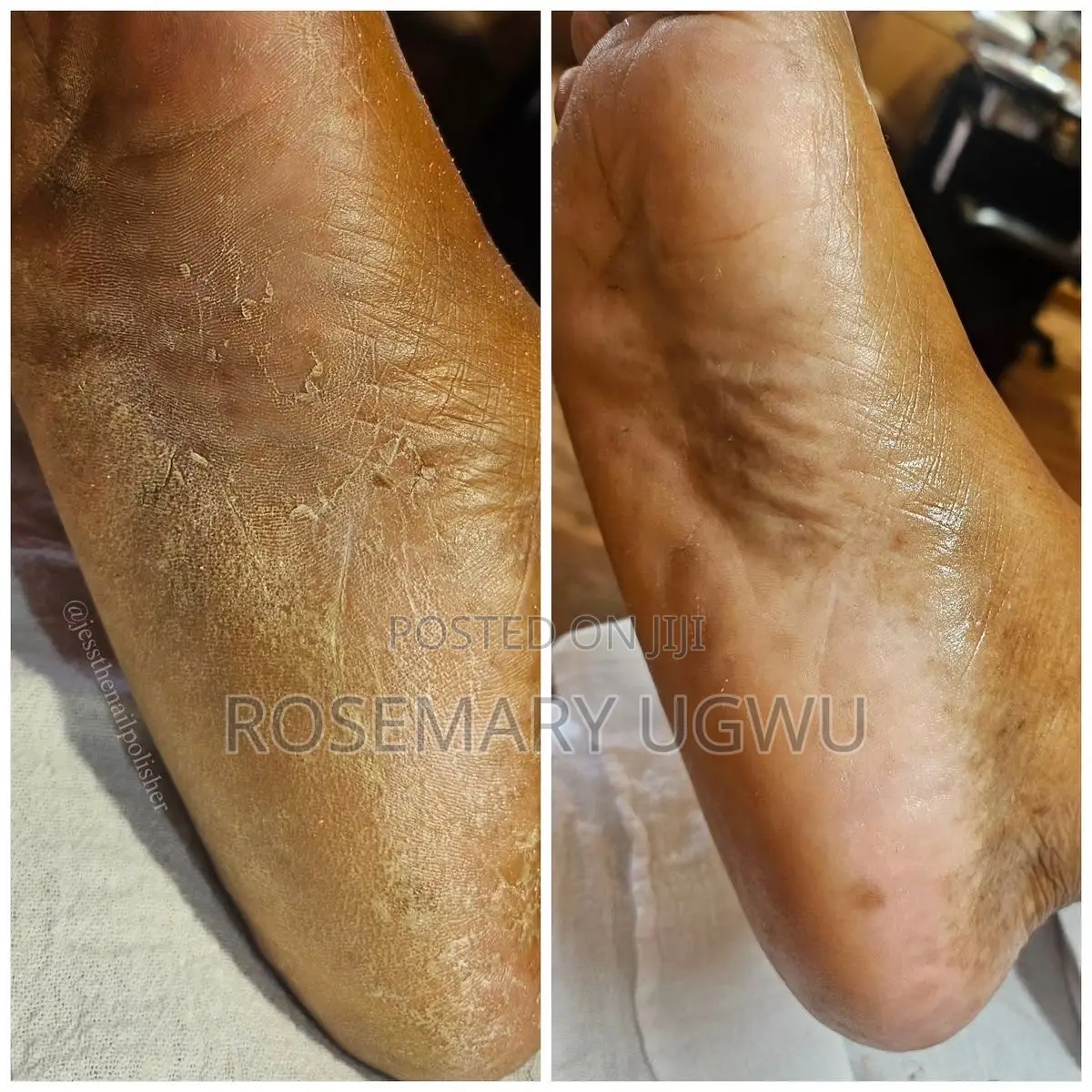 Pedicure and Manicure