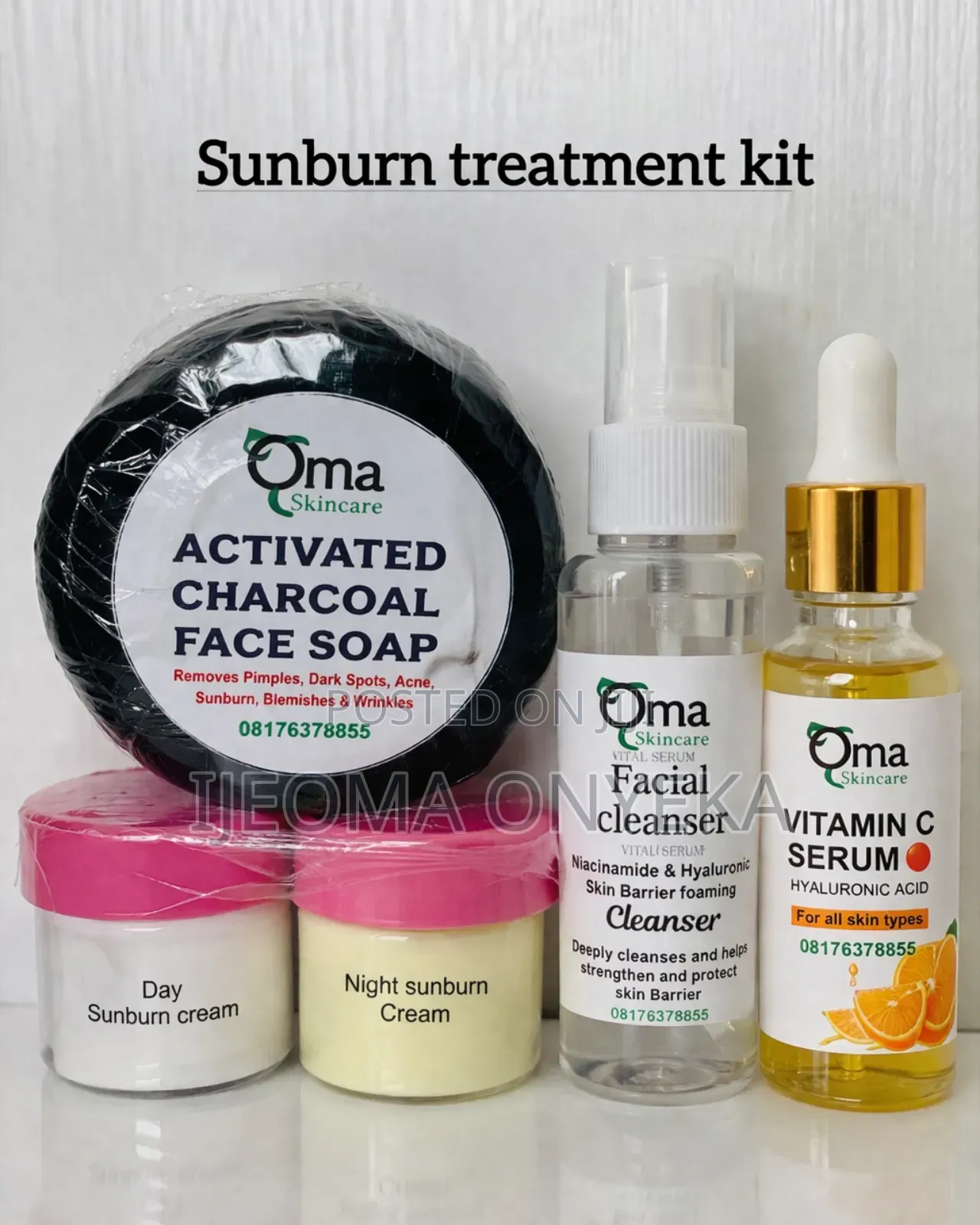 Sun Burn Kit