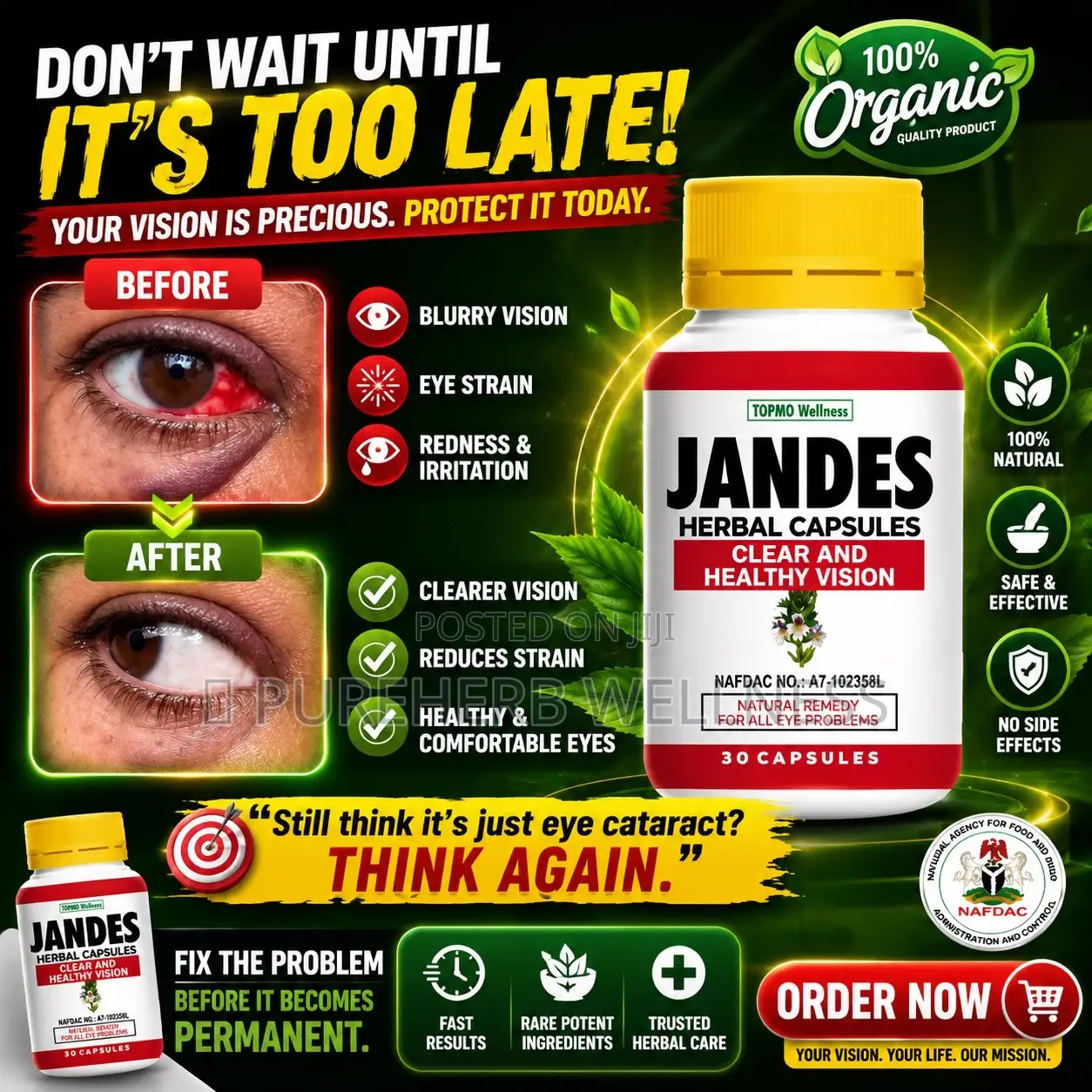 Jandes Eye Capsule
