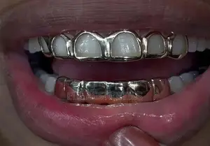 Teeth Grilz