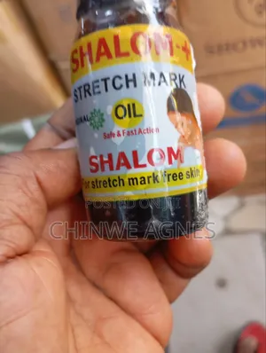 Stretch Mark Removal