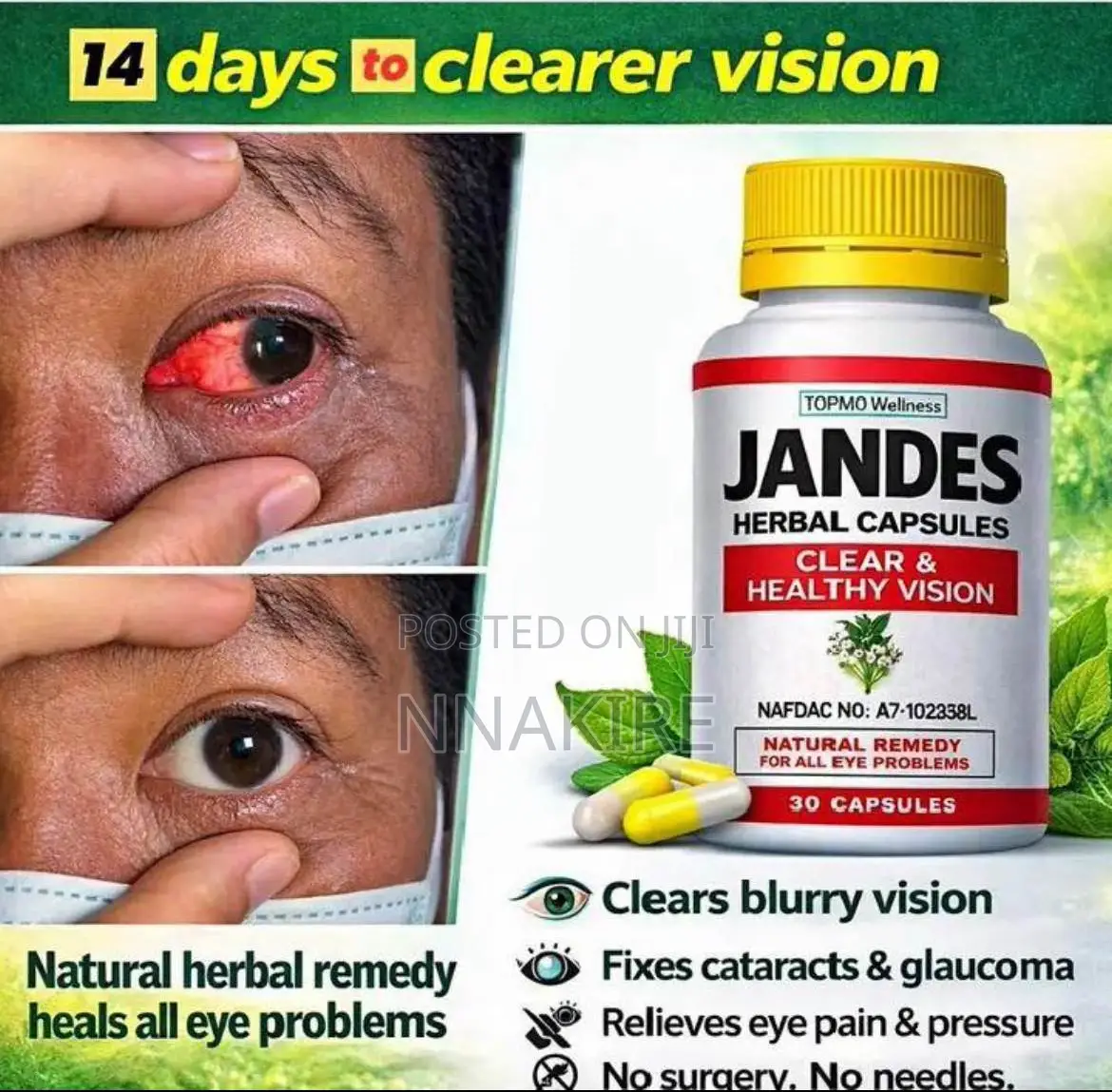 Jandes Herbal Capsule (Clearer Vision)
