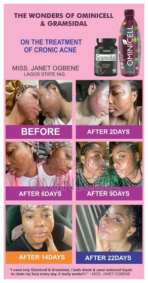 Xluminar Collagen/Gluthathione
