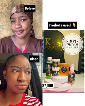 Pimple / Acne Treatment Set