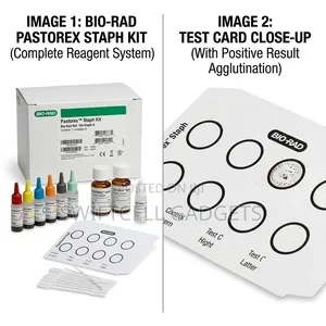 Pastorex Strep and Pastorex Staph Reagent (Biorad)