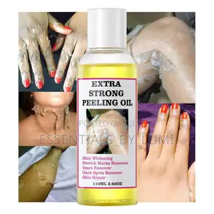 Extra Strong Yellow Peeling Oil for Dark Spot