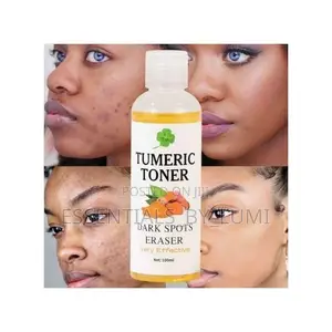 Turmeric Toner Dark Spots Remover