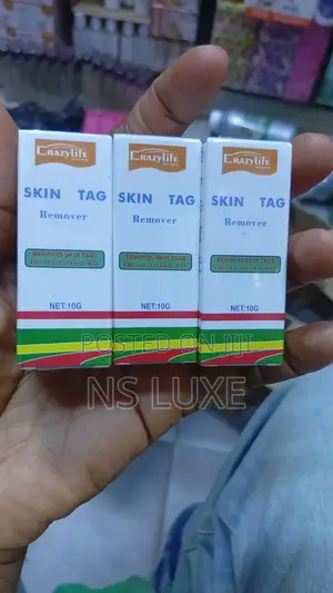 Skin Tag Removal