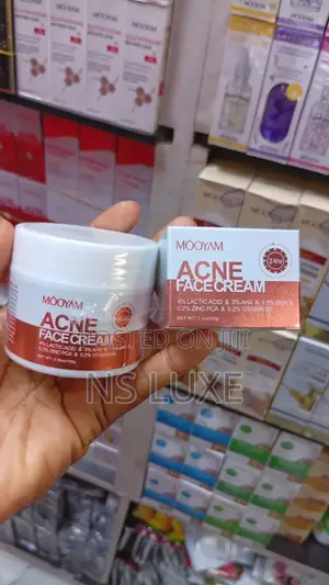 Acne Face Cream