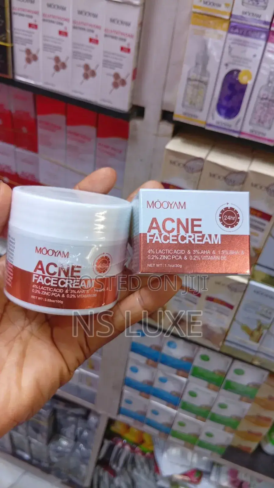 Acne Face Cream