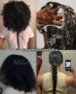 Hair Retention Consultation