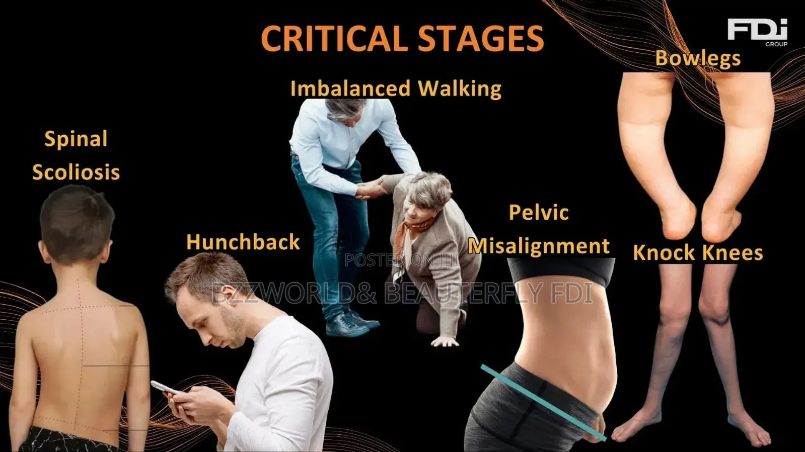 Goarch Insoles