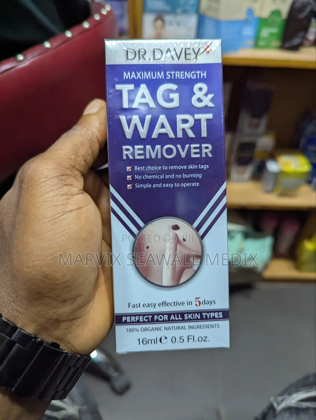 Wart Remover
