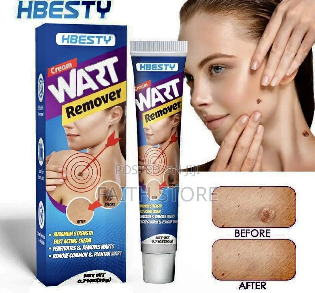 Hbesty Warts/Skin Tags Remover Cream (Surest Solution %