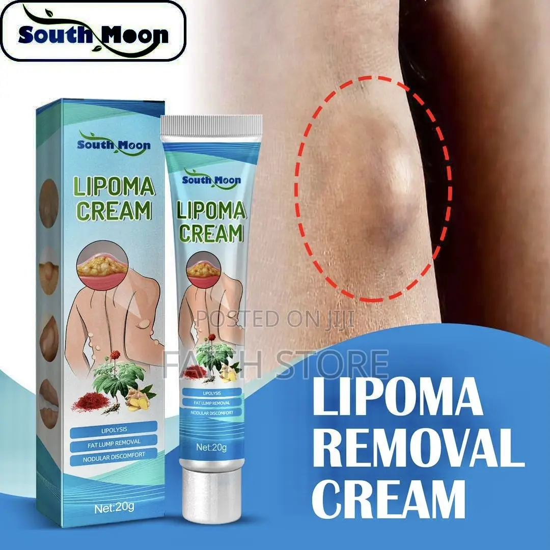 Lipoma Removal/Relief Cream