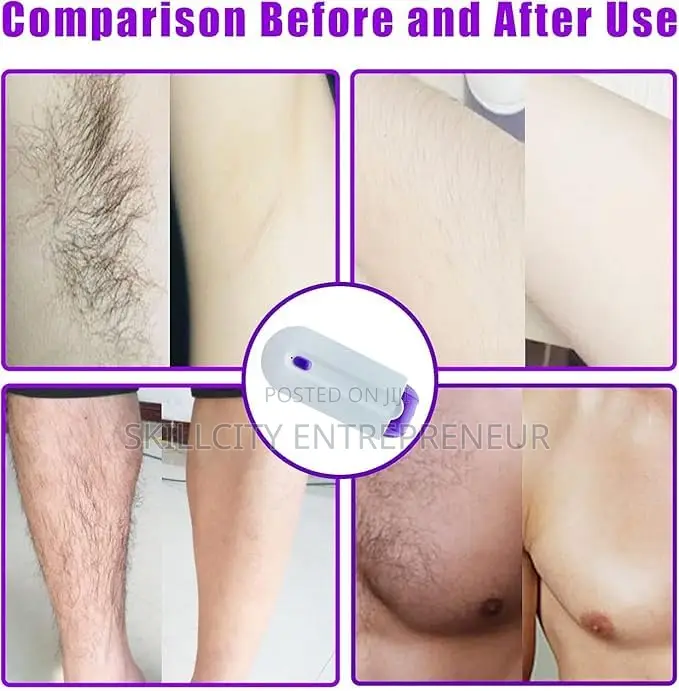 Yes Painless Hair Removal