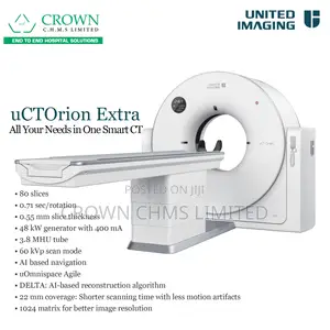 United Imaging Uct Orion Ct Scan – Advanced Diagnostic Imaging System