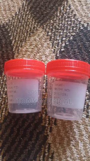 Sputum Bottles 120m and 60ml
