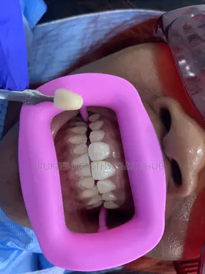Basic Teeth Whitening