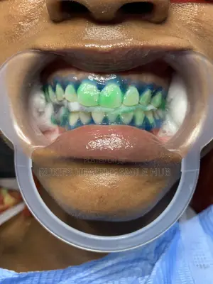 Basic Teeth Whitening
