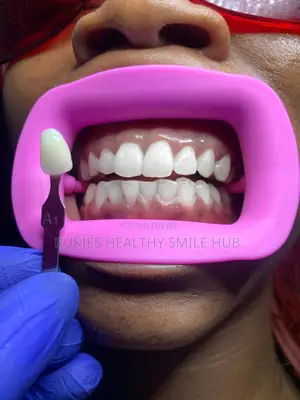 Basic Teeth Whitening