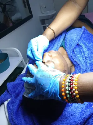 Acne Facial Treatment That Works