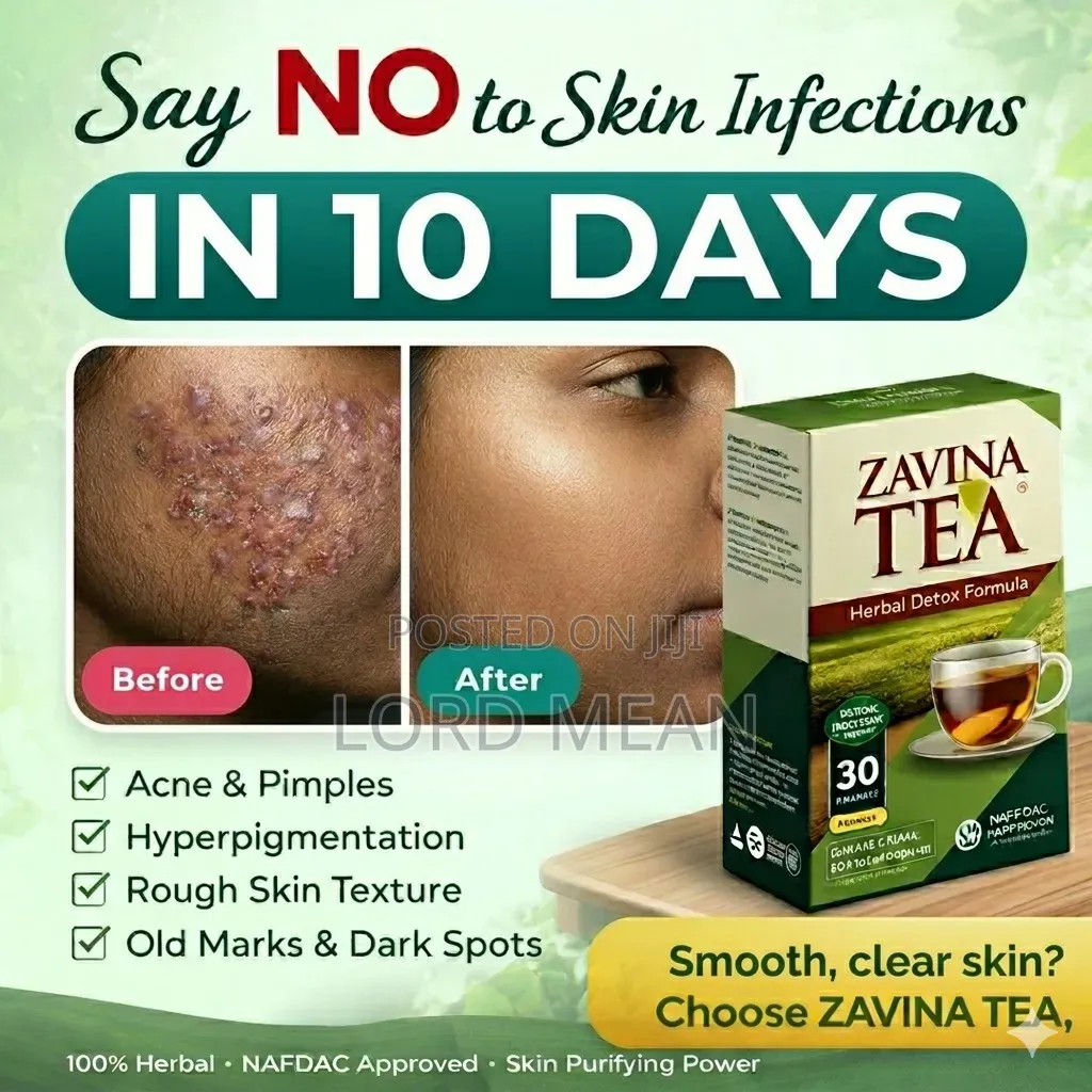 Zavina Infection Solution Tea