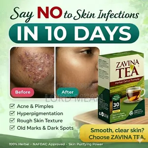 Zavina Infection Solution Tea