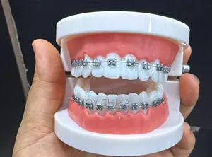 Tooth Brace and a Set of Earrings