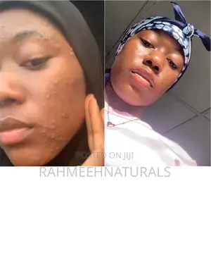 Rahmeehnaturals Skincare