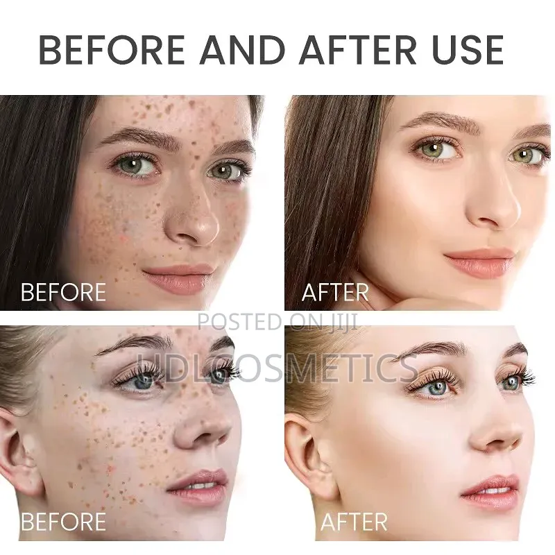 Estelin Body Toner and Serums