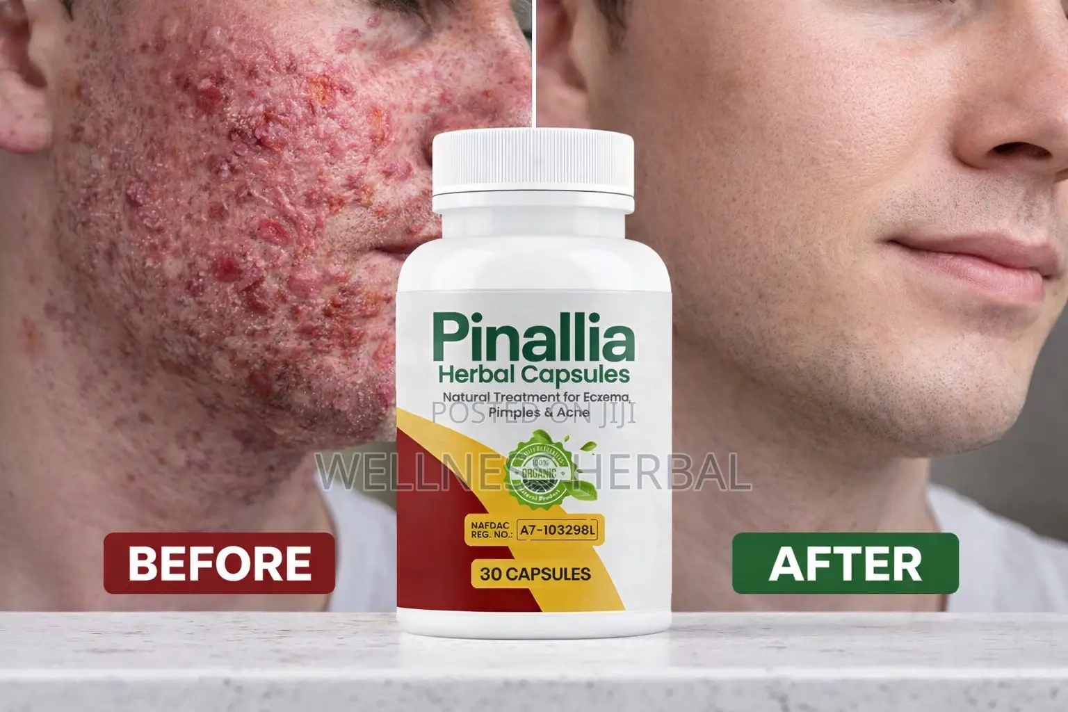 Pinallia Herbal Capsules