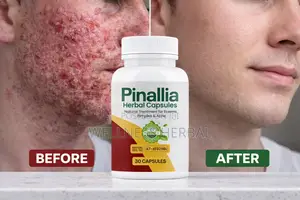 Pinallia Herbal Capsules