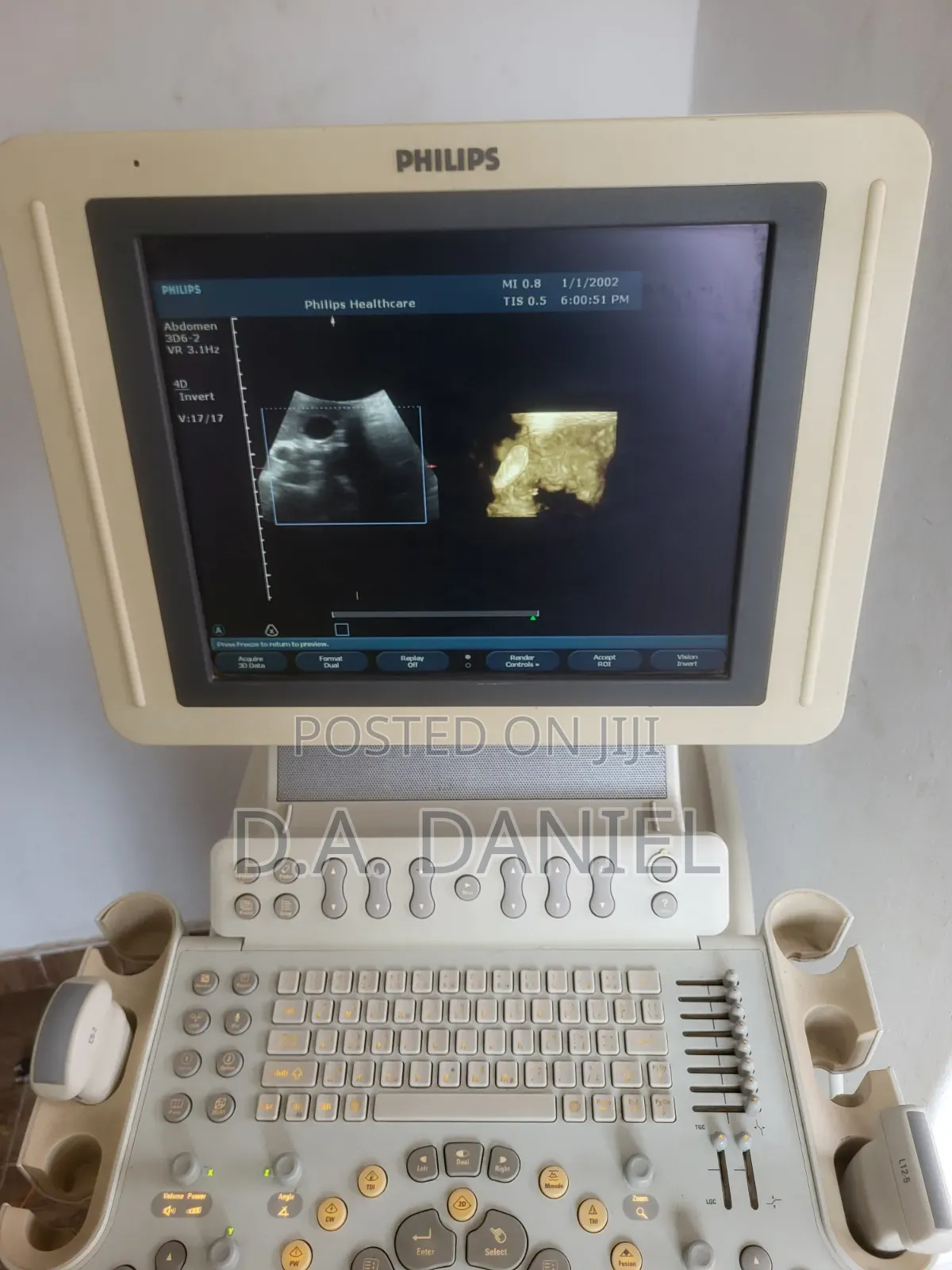 Philips Hd11 Xe