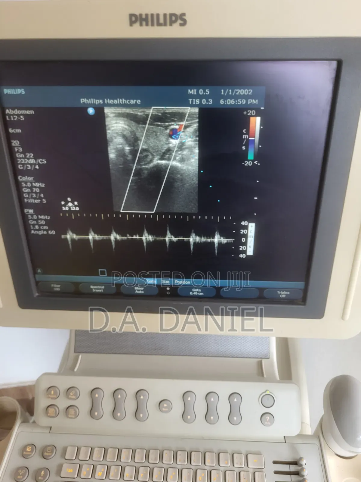 Philips Hd11 Xe
