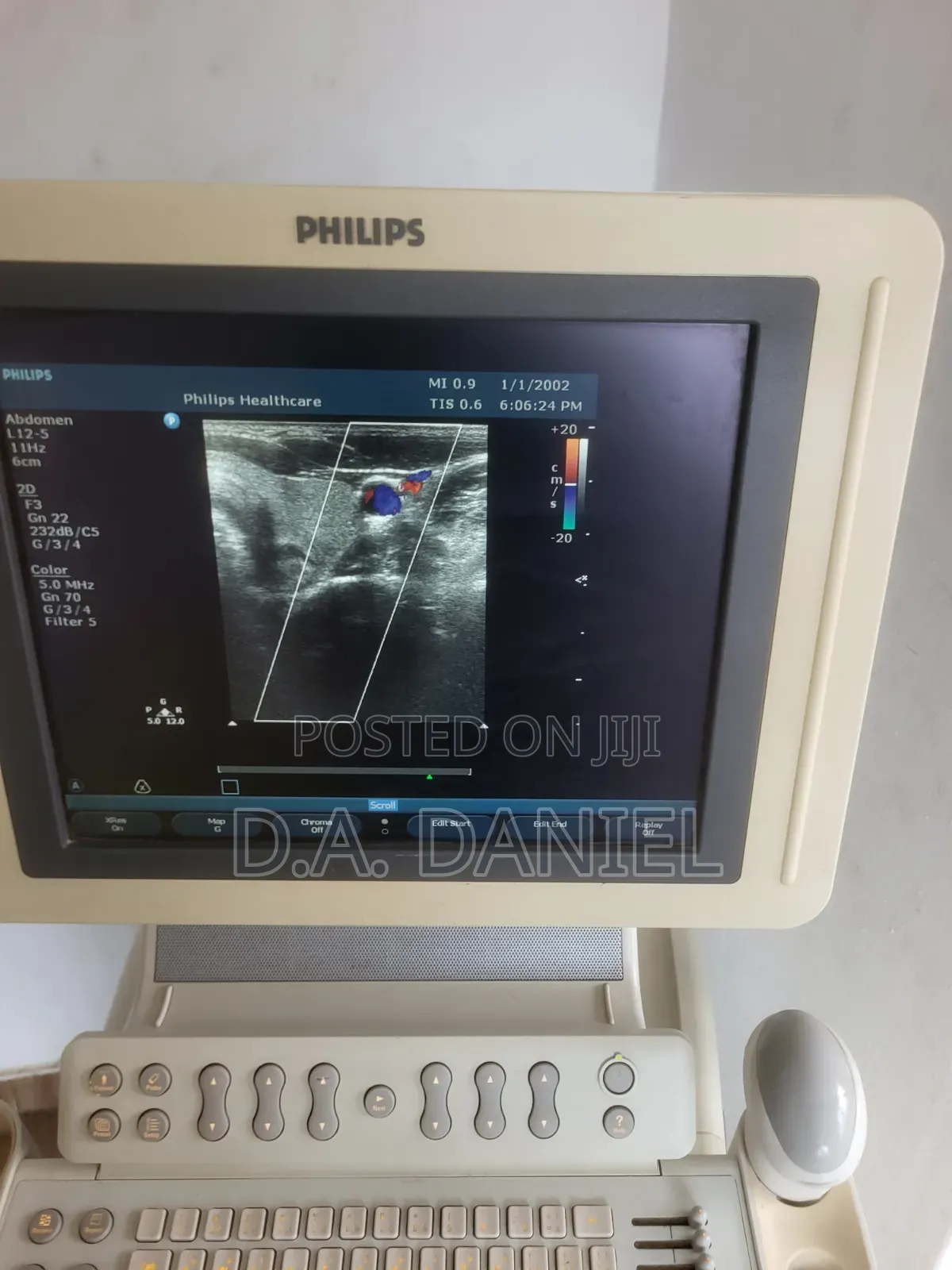Philips Hd11 Xe