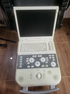 Siemens Acuson P300 Ultrasound