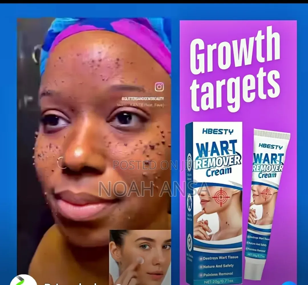 Hbesty Wart Remover Cream